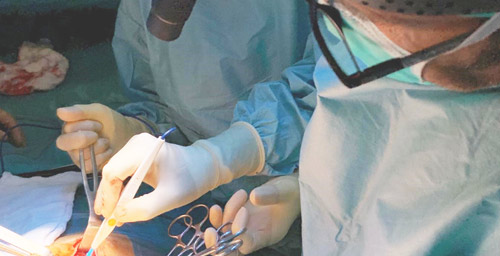 DIASTASI ADDOMINALE: DALLA FISIOKINESITERAPIA ALL’INTERVENTO CHIRURGICO